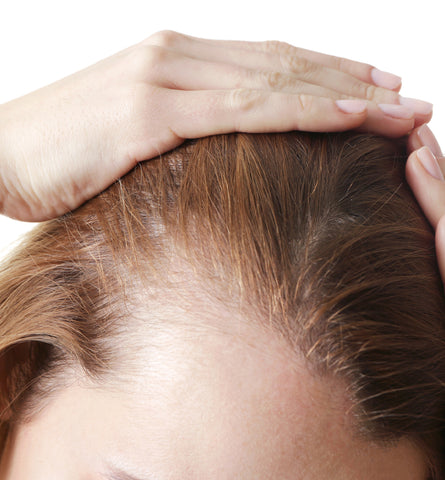 Blog Feed Article Feature Image Carousel: The Best Natural Shampoos for Hair Loss 