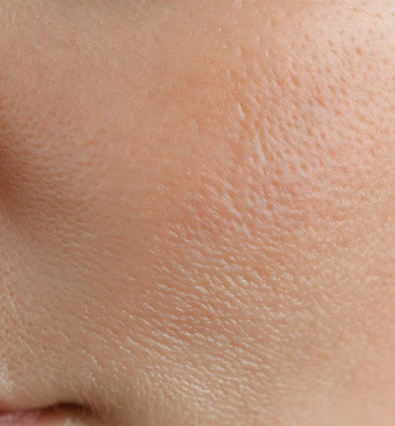 Blog Feed Article Feature Image Carousel: The Texture Reset: How to Smooth & Rebalance Skin After Routine Disruptions 