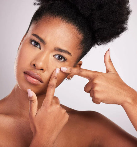 Blog Feed Article Feature Image Carousel: How to Get Rid of Blackheads: Expert-Approved Tips for Clearer Skin 