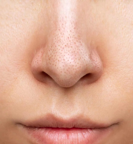 Blog Feed Article Feature Image Carousel: Say Goodbye to Large Pores: A Complete Guide on How to Make Pores Smaller & What Products to Use 