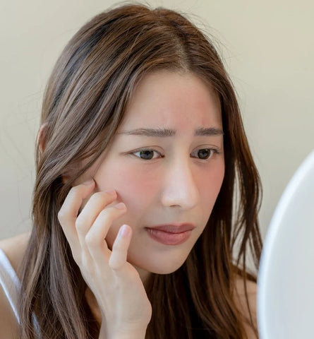 Blog Feed Article Feature Image Carousel: Sebaceous Filaments 101: What They Are and How to Make Them Disappear 